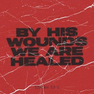Isaiah 53:4-5 - Surely he took up our pain
and bore our suffering,
yet we considered him punished by God,
stricken by him, and afflicted.
But he was pierced for our transgressions,
he was crushed for our iniquities;
the punishment that brought us peace was on him,
and by his wounds we are healed.