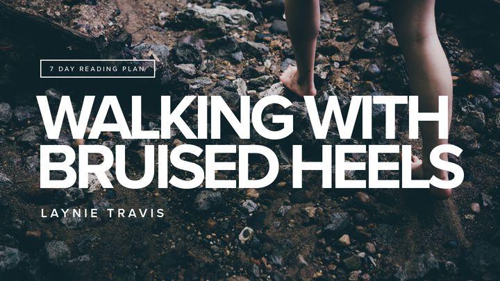 Walking With Bruised Heels