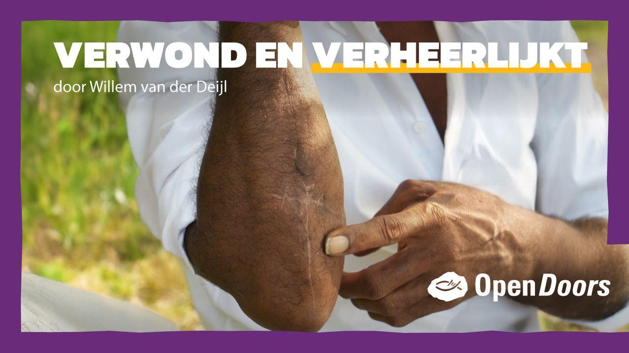 Open Doors | Verwond en verheerlijkt