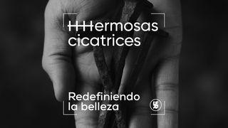 Hermosas Cicatrices (Redefiniendo La Belleza) ISAÍAS 53:2-5 La Biblia Hispanoamericana (Traducción Interconfesional, versión hispanoamericana)