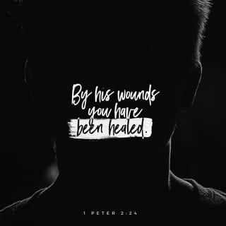 1 Peter 2:24 - He himself bore our sins in his body on the tree, that we might die to sin and live to righteousness. By his wounds you have been healed.